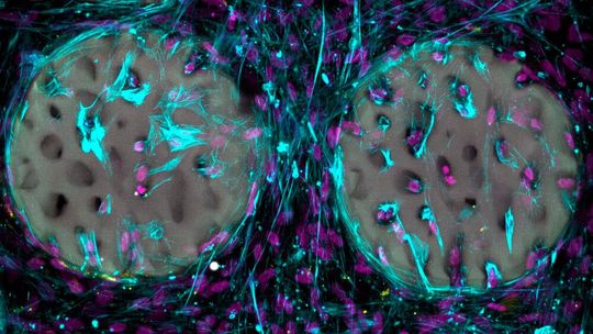 Ein gutes Zeichen: Knochenbildende Zellen (hellblau) mit Zellkernen (violett) haben ein Hydrogel, das wie Knochen strukturiert wurde, bereits besiedelt. (Bild:  Margherita Bernero / ETH Zürich)