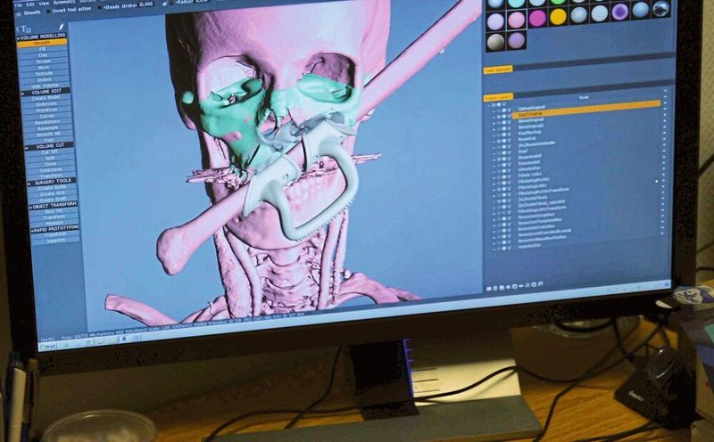 Im 3D-Lab werden Patientendaten modelliert. Das spart wertvolle Zeit im Operationssaal. (Reinhardt / Devicemed)