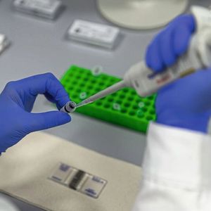 2a Vorbereitung für das Zählen der Zellen in einer Zählkammer (Trypanblau-Färbung)(Bild:  Carl ZEISS Microscopy)