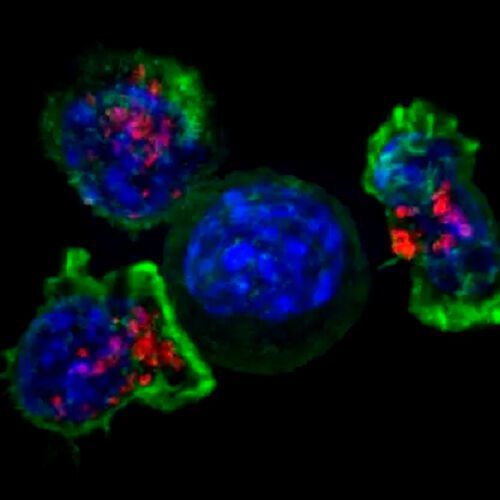 Killer T cells surround a cancer cell. Killer T cells surround a cancer cell.