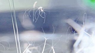 Das Beispiel des Süßwasserpolypen Hydra zeigt, dass eine Überfütterung des Mikrobioms möglichweise zur Krankheitsentstehung beiträgt. (© Kiel Life Science)