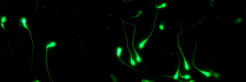 Sample of human spermatozoa