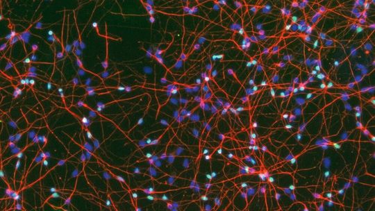 Im Labor gezüchtete Gehirnzellen aus humanen Stammzellen: Farbstoffe markieren typische Merkmale kortikaler Nervenzellen (grün und rot) sowie die Zellkerne (blau).(Bild:  Tanja Orschmann & Svenja Lorenz)