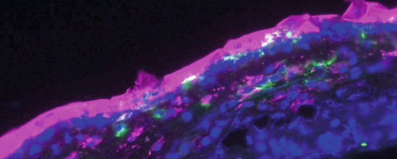 Fluoreszenzmikroskopische Aufnahme der mit Aptamercreme behandelten Haut: Die Aptamere (hier pink markiert) wurden in Form einer Salbe auf die oberste Hautschicht aufgetragen und drangen auch in tiefere Hautschichten ein (Zellkerne: blau; Antigen-präsentierende Zellen: grün).(Bild:  Marlene Gottschalk)