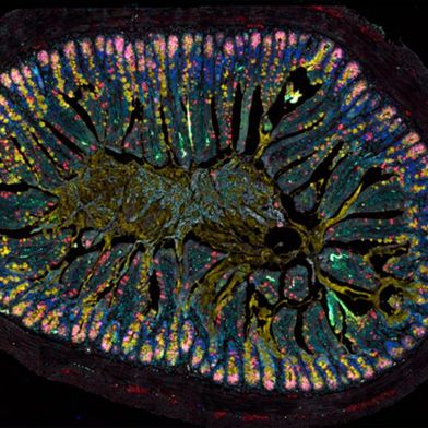 This tissue section, taken from the intestine of a mouse unable to produce the neuropeptide VIP, clearly shows the striking frequency with which certain cell types occur on the intestine's surface. These include villous cells (red), mucus-producing goblet cells (yellow), Paneth cells (pink) and stem cells (green).  (Source: © Charité | Luisa Barleben)