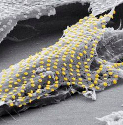 An array of gold nanodots was “tattooed” onto a living fibroblast cell. An array of gold nanodots was “tattooed” onto a living fibroblast cell.