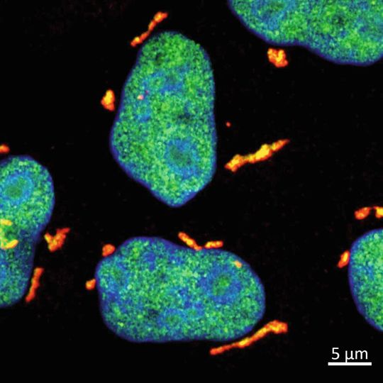 Nachdem UV-Strahlung Schäden an der RNA verursacht hat, bilden die Proteine DHX9 und G3BP1 im Zytoplasma der Zelle so genannte Stressgranula. Unter dem Mikroskop erscheinen diese Stressgranula in Grün (DHX9) und in Rot (G3BP1). Die Kerne der Zellen sind blau gefärbt. Das Protein DHX9 ist nicht nur in den Stressgranula im Zytoplasma, sondern auch im Zellkern zu finden.  (Bild:  MPI für Immunbiologie und Epigenetik/ Akhtar)
