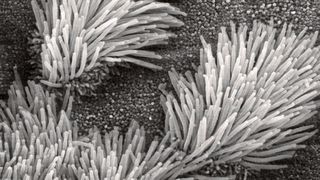 Elektronenmikroskopieaufnahme von Zilien des Lungenepithels (Symbolbild) (Bild: Charles Daghlian, remf.dartmouth.edu/imagesindex.html, "Bronchiolar epithelium 3 - SEM")