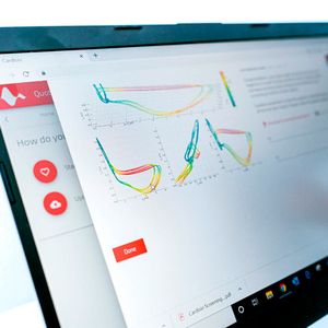 Die aufgenommenen Parameter werden an den Cardisio-Server übermittelt, mittels  KI-Algorithmus wird in fünf Minuten der Report erstellt(©  Cardisio GmbH)