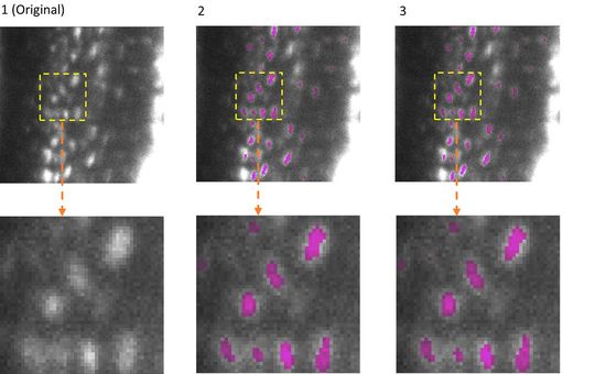 The adaptability of Efficient-Bio-AI was tested using several applications. One example is the 3D semantic segmentation. The AI model identifies specific structures within a three-dimensional cellular environment. The illustration shows the segmentation of osteocytes (mature bone cells) in images of mouse bones. The images were taken using light sheet fluorescence microscopy. The figure shows the original image (column 1), the segmentation by the FNet 3D model (column 2) from the MMV_Im2Im toolbox for image-to-image transformation, and the segmentation after compression of FNet 3D by EfficientBioAI (column 3). The comparison (columns 2 and 3) shows that compression does not reduce the accuracy of the segmentation at all.(Source:  Isas / Prof. Dr. Anika Grüneboom (Bioimaging))