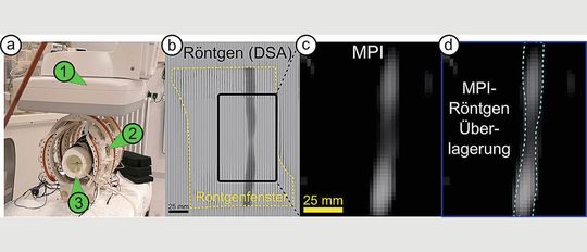 Der iMPI-Scanner (links) ermöglicht neue Einblicke in den menschlichen Körper. Hier zu sehen ist eine Engstelle in einem Blutgefäß – aufgenommen mit konventionellen Röntgenstrahlen (b), mit dem Scanner (c) und in einer Kombination beider Techniken (d).(Bild:  Patrick Vogel / Stefan Herz)
