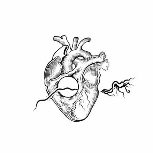 ASD is a common adult congenital heart disease. ASD is a common adult congenital heart disease.