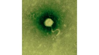 Elektronenmikroskopische Aufnahme eines Bakteriophagen. (Bild: Dinhopl/Vetmeduni Vienna)