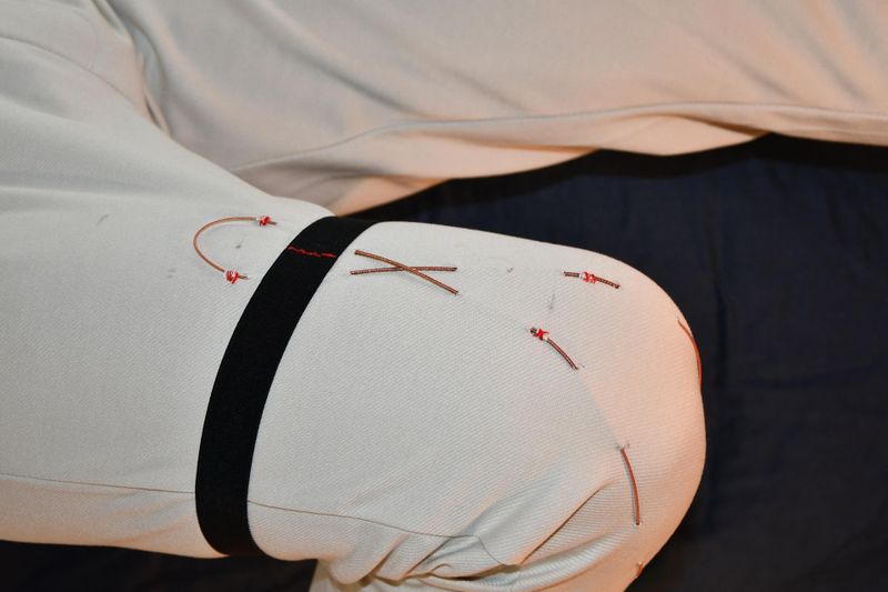 The team also integrated the FiberMotor into a prototype garment designed to fit the shape of a knee. Because the motors are thin and lightweight, the researchers envision that they could be distributed throughout a smart textile rather than concentrating the force in a single, rigid motor unit. (Source: EPFL)