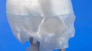 Das Laser Zentrum Hannover hat viel entwicklerisches „Hirnschmalz“  investiert und präsentiert auf der LASYS 2016 in Stuttgart unter anderem wie individuelle Magnesium-Implantate mithilfe des selektiven Laserstrahlschmelzens (SLM) noch besser hergestellt werden können. (Bild: LZH)