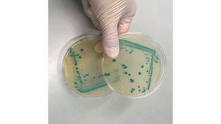 Listerien sind Überlebenskünstler, den Hygienemaßnahmen in der Lebensmittelproduktion entkommen sie etwa dank einer nun identifizierten, genetischen „Stressinsel“. ( Institut für Milchhygiene/Vetmeduni Vienna)