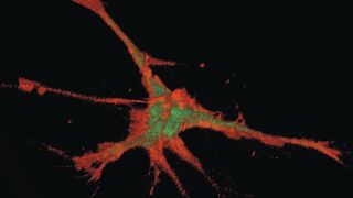 Magnetisch fanden die Nanopartikel ihren Weg in die Spitzen der Fortsätze von Nervenzellen. (Bild: © Molekulare Neurobiochemie)