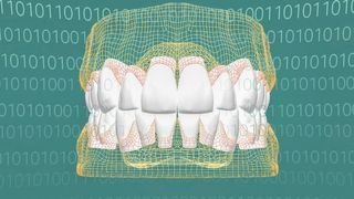 Bei Heraeus Kulzer geht niemand auf dem Zahnfleisch und kein Zahn bröckelt; denn das Dentalunternehmen digitalisierte und optimierte: Alle Zähne passen. (AWS)