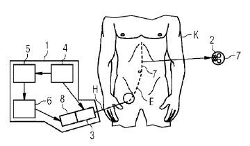 Verfahren und Vorrichtung zur Steuerung der Bewegung eines länglichen medizinischen Instruments innerhalb eines Körpers(Bild:  Siemens Healthineers/DPMA)