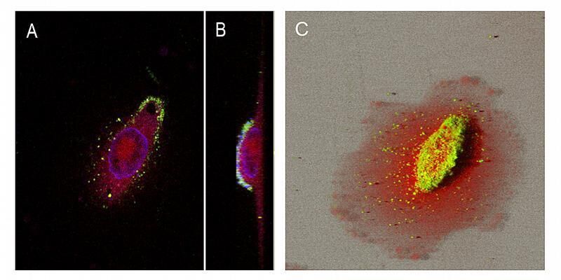 Eine Krebszelle in Aufsicht (A), Seitenansicht (B) und in 3D-Rekonstruktion (C), die mithilfe von Nanopartikeln (grün) einen Wirkstoff (Vasoactives Intestinales Peptid, rot) aufgenommen hat. Der Zellkern ist blau eingefärbt.  (Bild: Uni Graz/Andreas Zimmer)