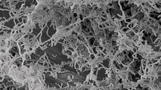 Auch der Hauptverursacher von Karies, Streptococcus mutans, kann Resistenzen gegen das Antiseptikum Chlorhexidin bilden. (Universitätsklinikum Freiburg)
