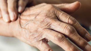 Nach Alzheimer ist Parkinson die zweithäufigste neurodegenartive Erkrankung. (©ipopba - stock.adobe.com)
