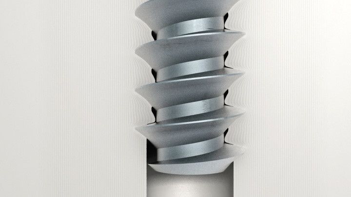 Remform-Schrauben furchen sich selbständig ihr Gewinde in das vorhandene Kernloch des Kunststoffbauteils (Bild: Arnold Umformtechnik)