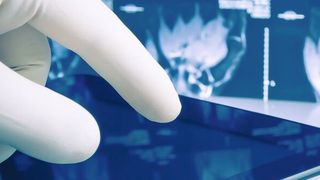 Digitales Röntgen ermöglicht die einfache Verarbeitung sowie sofortige Verfügbarkeit der Aufnahmen und reduziert die Strahlenbelastung der Patienten. Eine neue Technologie soll jetzt die Qualität der Bilder effizient und kostengünstig verbessern. (Bild: ©donfiore - stock.adobe.com)