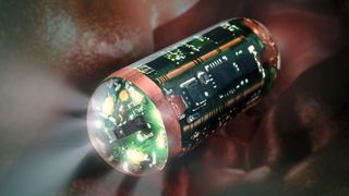 Nuendo (unternehmenseigene Schreibweise: nuEndo) macht den unangenehmen Schlauch in der Speiseröhre überflüssig. Der Patient braucht zukünftig nur noch eine kleine Kapsel schlucken, die ihre Bilder auf einen Monitor streamt. (Bild: Fraunhofer IZM / Volker Mai)