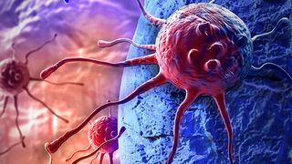 Aktive Tumorzellen im menschlichen Körper  (vitanovski - stock.adobe.com)