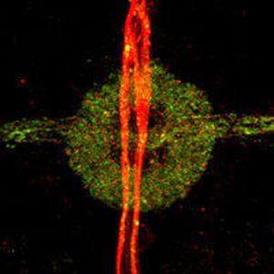 (AG Strauss, Johannes Gutenberg Universität)