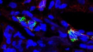 Mikroskopiebild der der neu entdeckten Vorläuferzellen.  (© MPI-IE/ Dominic Grün)