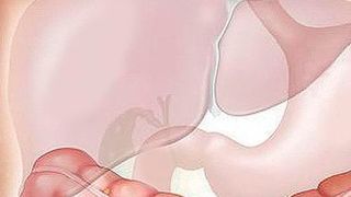 Spezielle Leberfette können ein Warnzeichen für Fettlebererkrankung und Insulinresistenz sowie in der Folge von Typ-2-Diabetes sein. (Symbolbild) (gemeinfrei)