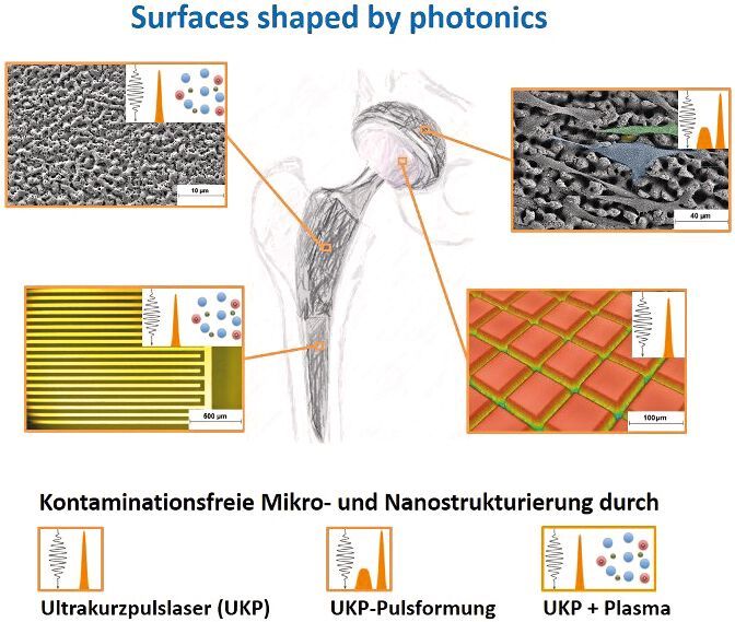 Mit dem Ultrakurzpulslaser kann jedes Material in hoher Präzision bearbeitet werden. Der Laser kann bohren, schneiden, fräsen und Oberflächen im Mikrometerbereich strukturieren. (Bild: Mikrolas)