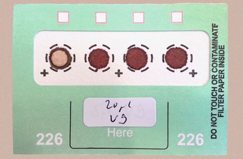 Abb. 2: DBS-Karte nach der Desorption mit dem Gerstel-DBS-Autosampler. (Bild: Gerstel)