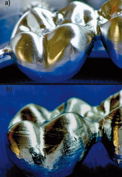 Vergleich der Oberflächengüte von gefrästen Zahnersatzteilen. a gefertigt auf der CNC-Fräsmaschine Millmachine XL, b übebrlicherweise gelieferte Oberfläche (Archiv: Vogel Business Media)