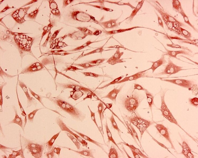 Mit cytopathogenem BVDV infizierte Fibroblasten-Zellkultur (Virus angefärbt mit 3-Amino-9-Ethylcarbazol [AEC]). (Bild: BVD-Info.ch)