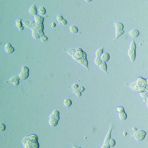 Abb. 2: Adhärenz und Morphologie: HEK-293-Zellen wurden in einer 96-Well-Platte ausgesät und in Serum-freiem Medium kultiviert (37 °C, 5% CO2). Nach 48 Stunden sind die Zellen auf der Standard-Zellkulturoberfläche nur semi-adhärent.