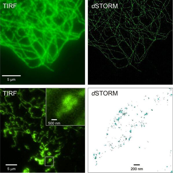 4	 Mit dSTORM können beispielsweise zelluläre Strukturen (oben, Mikrotubulingerüst) oder die Organisation von Proteinen in subzellulären Organellen (unten, Cytochrom-c-Oxidase in der mitochondrialen inneren Membran) mit höchster Auflösung abgebildet werden; Aufnahmen mit normaler Fluoreszenzmikroskopie unter Totalreflexion (TIRF, links), hochaufgelöste dSTORM-Bilder (rechts). (Archiv: Vogel Business Media)