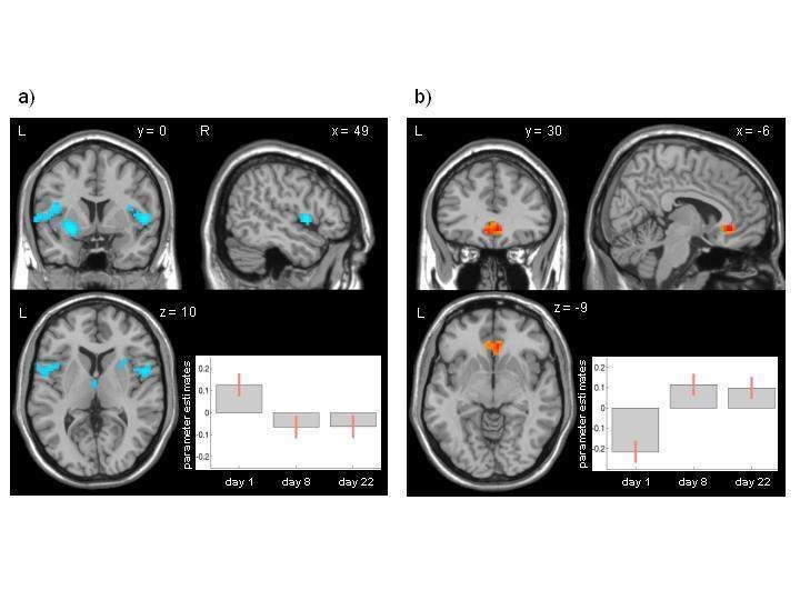 Eine wiederholte schmerzhafte Stimulation über eine Woche ruft die Aktivierung der körpereigenen Schmerzmodulation hervor, welche mit einer deutlichen Reduktion der Schmerzwahrnehmung und schmerzevozierten Antworten einhergeht.  (Foto: U. Bingel)