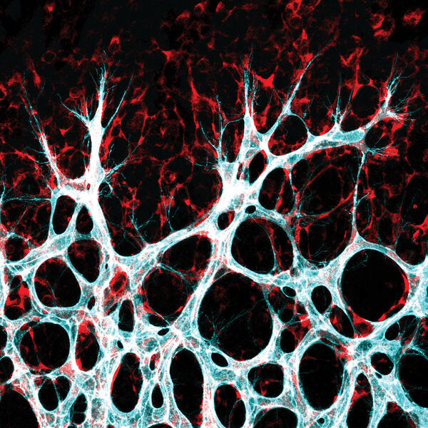 Versorgungsnetz des Körpers  Blutgefäße müssen ihr Wachstum an das in ihrer Umgebung vorhandene Nährstoffangebot anpassen, um Organe bedarfsgerecht zu versorgen. Ein Team vom Max-Delbrück-Centrums für Molekulare Medizin und des Berlin Institute of Health in der Charité hat zwei Proteine beschrieben, die eine wichtige Rolle in diesem Prozess spielen. Im Bild ist das wachsende Blutgefäßnetzwerk in der Netzhaut einer Maus gezeigt, sichtbar gemacht durch Immunfluoreszenzfärbung und konfokale Mikroskopie. Dargestellt sind die Zellen der Gefäßinnenwand – die Endothelzellen (türkis/weiß), die in das umgebende Gewebe einwandern, um dort neue Verbindungen zu bilden.  Hier gehts zur Originalmeldung Wissenschaftsbild des Tages vom 12.7.2022  (AG Potente)