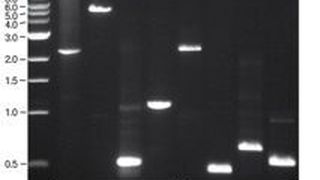 Eine Auswahl an humanen und C. elegans DNA-Sequenzen mit unterschiedlichem AT- und GC-Gehalt wurde mit OneTaq DNA-Polymerase amplifiziert. Spur M = Größenstandard  (Bild: NEB)