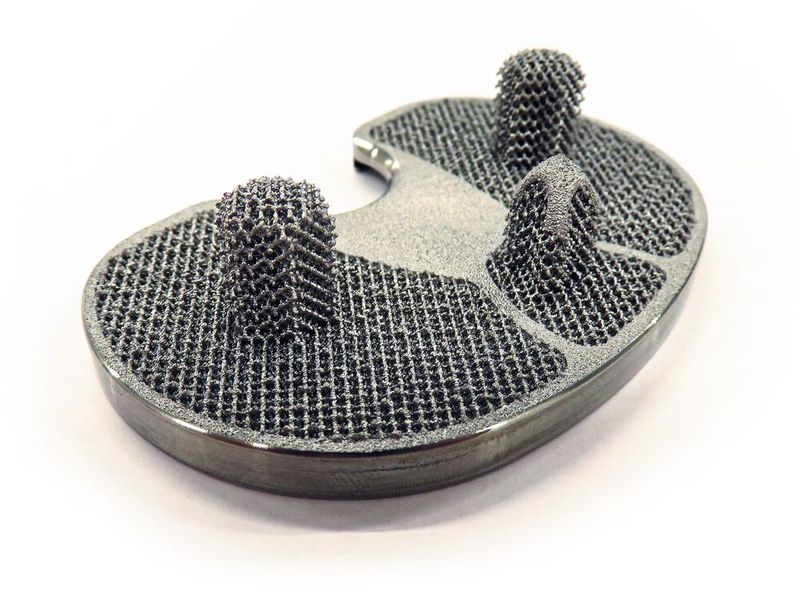 Der Erfolg der Hüftgelenkspfanne überzeugte Lima Corporate davon, dass sich mit TT auch andere Implantate in 3D drucken lassen. So ging das Unternehmen die zementfreie Knie-Totalendoprothese (TKA) an. (Bild: Siemens)