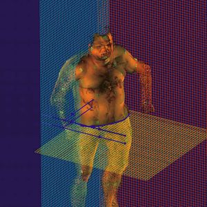 Abb.1: Dreidimensionale,
farbige und nahezu
photorealistische
Gesamtkörperdokumentation;
Vermessung
der Wunde am Rumpf