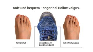 Diese Darstellung veranschaulicht, welche Vorteile der Schuh „Sky“ von Baak auch den von Hallux valgus geplagten Menschen bietet. (Bild: Baak)