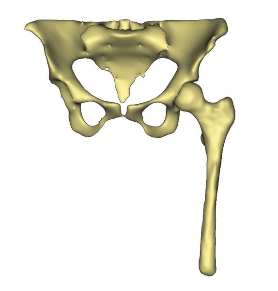 Segmentierte Geometrie mit Knochen-, Muskel- und Fettgewebe. (Bild: CAPS/TU München)