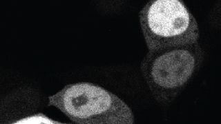 Mikroskopieaufnahmen von menschlichen, embryonalen Nierenzellen in Kultur (Ausschnitt) ... (Bild: Dominik Niopek)