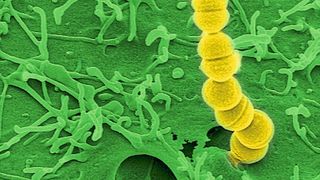 Streptococcus pyogenes löst am häufigsten nekrotisierende Fasziitis aus. (HZI / Manfred Rohde)