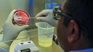 Mikrobielle Ökosysteme lassen sich im Labor nur schwer nachbilden: Viele Mikroben sterben, wenn man sie kultivieren will. Forschende der Universität Oldenburg zeigen nun, dass ihr Überleben weniger von individuellen Bedürfnissen als von einem empfindlichen Netzwerk wechselseitiger Abhängigkeiten abhängt – das schon durch kleine Störungen kollabieren kann. (Symbolbild) (Bild: frei lizenziert)