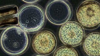 Coscinodiscus wailesii ist eine Mikroalge, die zu der Familie der Kieselalgen gehört. Sie bildet Algenblüten und produziert erhebliche Mengen an langkettigen Zuckern. (Bild: Max-Planck-Institut für Marine Mikrobiologie/ C. Robb)